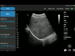 CE Marked 3.6MHz Convex Probe Compatible with Android and iOS System