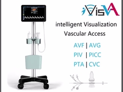 Ultrasound-guided PTA