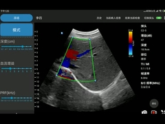 CE Approved Electronic Convex Array USG Cardiac Probe Ultrasound For Android