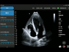 3.6MHz Portable Wireless Ultrasound Probe Phased Array Transducer