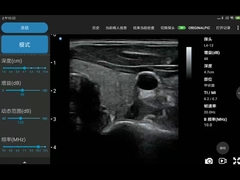 256 Scan Lines Ipad Ultrasound Transducer Wireless Ultrasound Probe For PICC