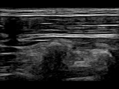 WiFi 12.6cm Remote Portable Doppler Ultrasound Machine 30 Fps