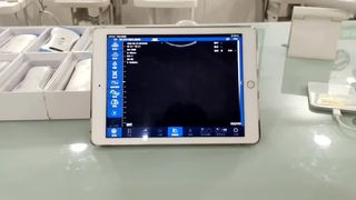 Dual Head Wireless Ultrasound Probe for OB GYN Diagnostics