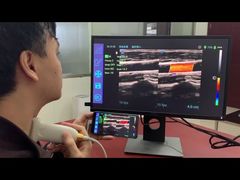 iTrason USB linear ultrasound probe used on smart phone/PC