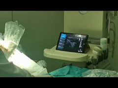 Golead wireless ultrasound used for anesthesia