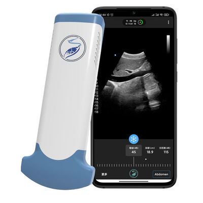 Buy CE Marked 3.6MHz Portable Wifi Ultrasound Scanners JPEG BMP PNG MPEG-4 online manufacture