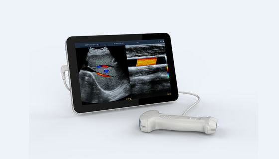 Buy 5V Dual Head Portable Handheld Ultrasound Scanner High Frequency online manufacture