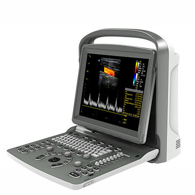 Buy 12 Inch LED Chison Portable Ultrasound Machine ECO6 With Long Battery Life online manufacture