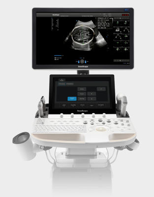 Buy Artificial Intelligence Based SonoScape Ultrasound Machine Trolley P60 Exp online manufacture