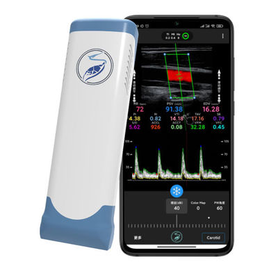Buy 12MHz Wireless Handheld Ultrasound Scanner for iPhone & iPad | Electronic Linear Array Color Doppler Probe online manufacture