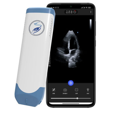 Buy Wireless Phased Array Handheld Ultrasound Scanner 5MHz Pocket Cardiac Ultrasound for POCUS Echocardiography online manufacture
