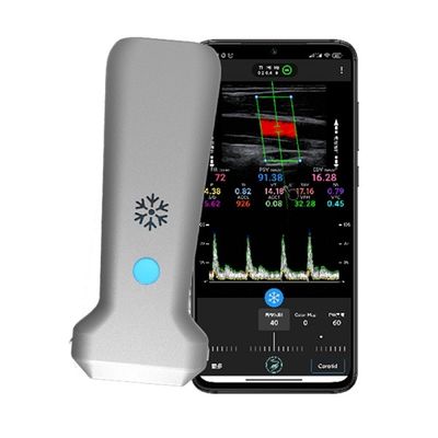 Buy WiFi Wireless Linear Handheld Color Doppler Ultrasound Scanner | 30 FPS Real-Time Imaging | Portable Medical Ultrasound Probe online manufacture