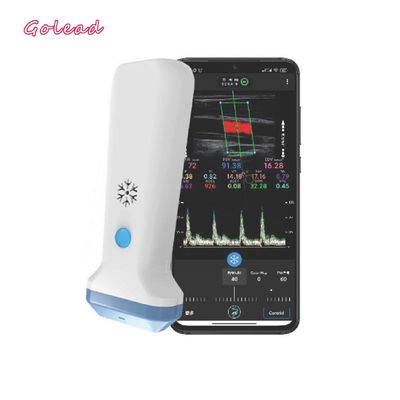 Buy 12MHz 3000mAh Wireless Probe Type Ultrasound Scanner For Iphone online manufacture