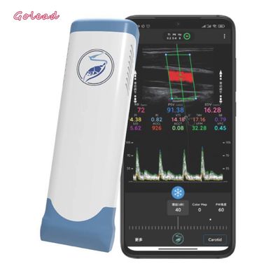 Buy Electronic Linear Array Wifi Wireless Portable Ultrasound Scanner 12MHz online manufacture