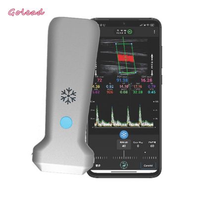 Buy 126mm Convex Probe Ultrasound Scanner For Vascular MSK Nerve online manufacture