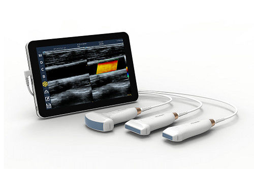 Buy USB Type-C Linear Handheld Ultrasound Scanner 10MHz Portable Android Ultrasound Probe for Vascular and POCUS online manufacture
