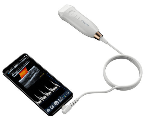 Buy Handheld Ultrasound Scanner with 12MHZ High Frequency Linear Probe for Accurate Vascular Access and PICC Insertion Procedures online manufacture