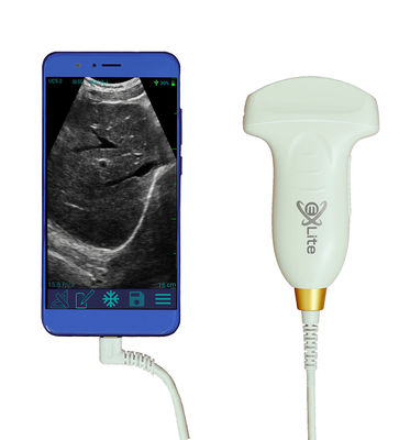 Buy Electronic Convex Array Color Doppler Handheld Ultrasound Scanner 3.5MHz online manufacture