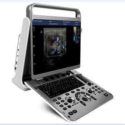 Buy Ergonomic Design Portable Ultrasound Machine Chison EBit 30 online manufacture