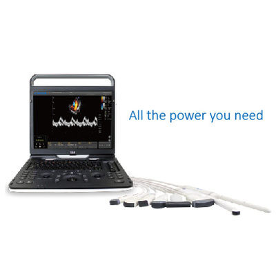 Buy 128 Element Wifi Ultrasound Chison EBit 60 For Cardiovascular online manufacture