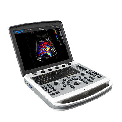 Buy 120° Rotatable Chison SonoBook 6 Portable Laptop Ultrasound Machine online manufacture