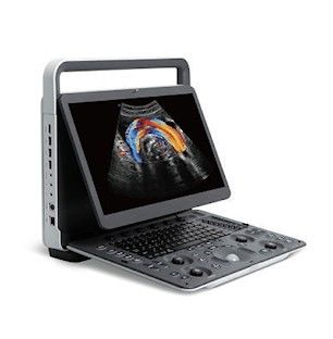 Buy Panoramic Imaging SonoScape E2 PRO Portable Ultrasound Machine online manufacture