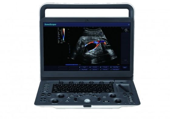Buy 7 Imaging Levels SonoScape E3 Portable Ultrasound Machine With 15.6 Inch Monitor online manufacture