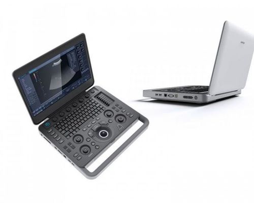 Buy Smart Sight 500GB Laptop SonoScape Ultrasound Machine With 15.6'' LCD online manufacture