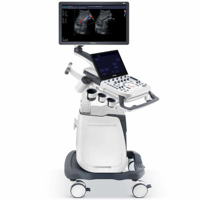 Buy 500GB Spatial Compound Imaging SonoScape Ultrasound Machine P25 online manufacture