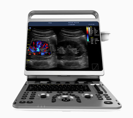 Buy Portable Cardiac Ultrasound Machine Chison EBit 50 16.5lbs online manufacture