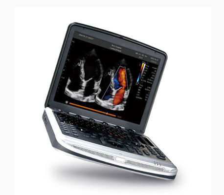 Buy FDA Approved Laptop Ultrasound Machine Chison SonoBook 8 For Echocardiography online manufacture