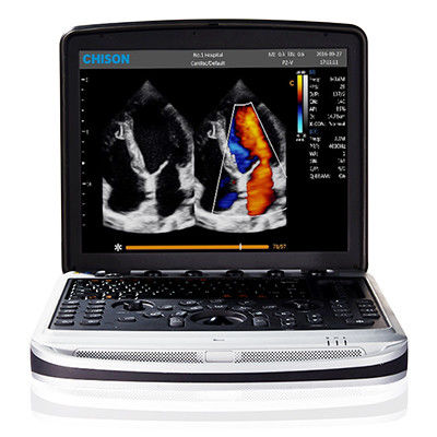 Buy Easy To Carry 4D Chison SonoBook 9 Laptop Ultrasound Machine online manufacture