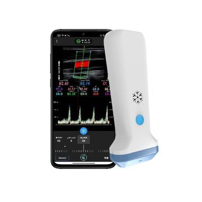 Buy Portable Color Doppler Wireless Linear Ultrasound Scanner 12.6cm Handheld POCUS Ultrasound for Healthcare Professionals online manufacture