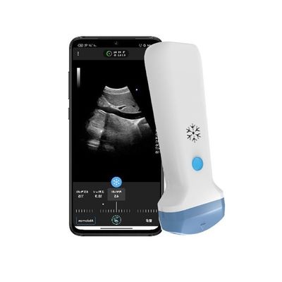 Buy HDMI Output Wireless Convex Handheld Ultrasound Scanner | 3.6MHz Portable Color Doppler POCUS Ultrasound online manufacture