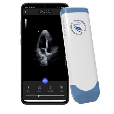 Buy Depth 18.9cm Handheld Ultrasound Scanner For Iphone 3.6MHz online manufacture