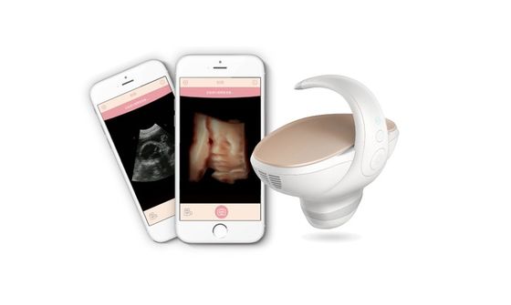Buy CE Approved 3D/4D Handheld Fetal Ultrasound Scanner
Portable Pregnancy Imaging Solution with 60° Wide-Angle Convex Probe online manufacture