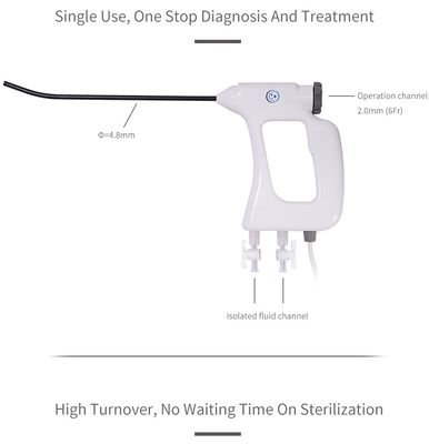 Buy FDA CE ISO13485 Disposable Electronic Hysteroscope 4.8mm for Gynecology Endoscopic Procedures online manufacture