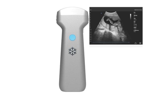 Buy Electronic Convex Array Convex Wireless Ultrasound Probe 2MHz 3.6MHz 5MHz online manufacture