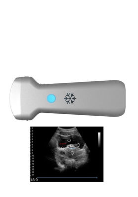 Buy Ultrasonication Convex Wireless Ultrasound Probe For Gynecology online manufacture