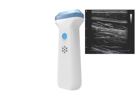 Buy DICOM BMP PNG JPEG 128 Element Wifi Ultrasound Probe 80 To180dB online manufacture