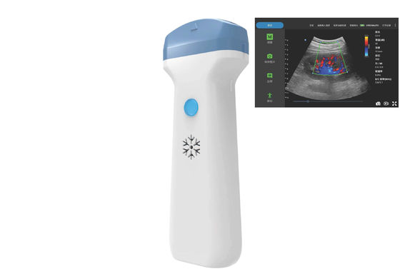 Buy 6000mAh Wireless Ultrasound Probe 128 Element Wifi Ultrasound CE online manufacture