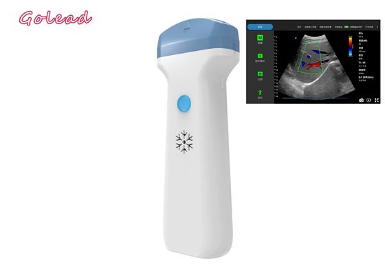 Buy Anesthesia Ipad Wireless Ultrasound Probe For POCUS Exams Primary Care online manufacture