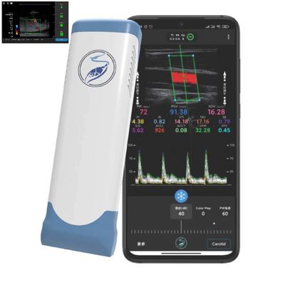 Buy 256 Scan Lines Ipad Ultrasound Transducer Wireless Ultrasound Probe For PICC online manufacture