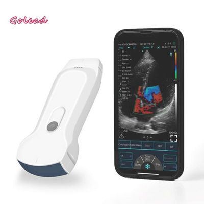 Buy 3 in 1 Wireless Ultrasound Probe with 8 Adjustment TGC WiFi Connection online manufacture