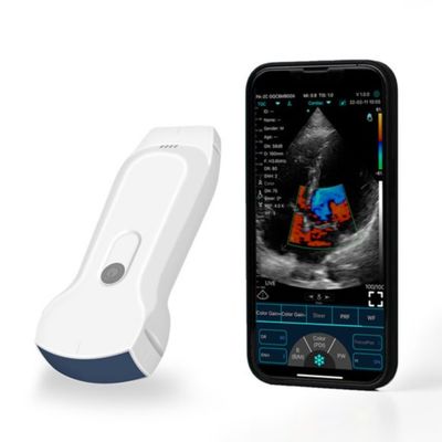 Buy POCUS Portable IPad Handheld Ultrasound Scanner For Clinical Diagnosis online manufacture