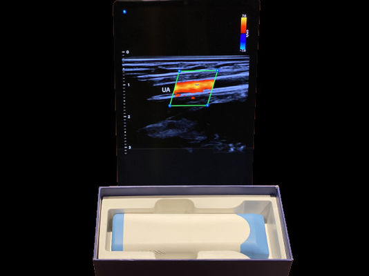 Buy Advanced Handheld Ultrasound Scanner 0.2kg With 3000mAh Battery For Medical online manufacture