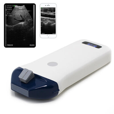 Buy Wireless Handheld Ultrasound System for Needle Guidance and Interventional Procedures online manufacture