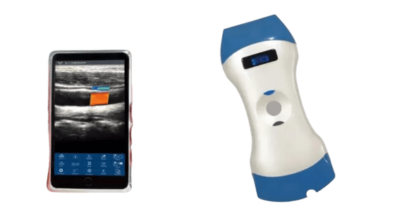 Buy 128 Element Dual Head Wireless Handheld Ultrasound Probe — One Probe for Deep Imaging, Superficial Imaging and Point-of-Care Diagnosis online manufacture