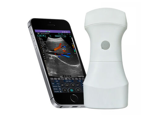 Buy Wireless Pocket Convex Ultrasound Scanner with Replaceable Battery for Portable Clinical Imaging online manufacture
