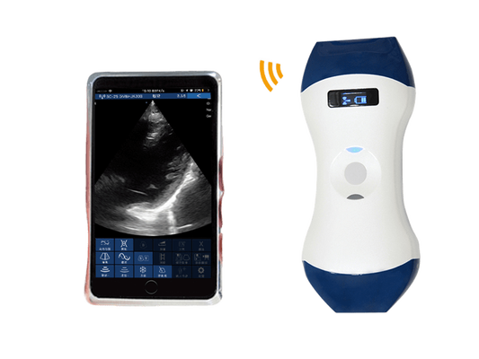 Buy FDA CE ISO13485 Palm Size Wireless Handheld Ultrasound Probe with Phased Array and Linear Dual Head for POCUS online manufacture
